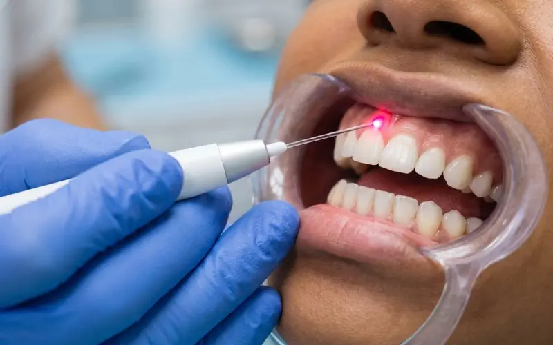 Dentist using a dental laser on the gum above a front tooth