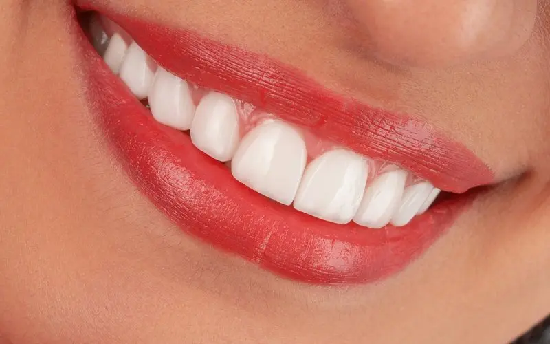 Close-up of a bright, even smile